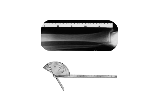 General Surgery Rulers & Calipers, Accessories