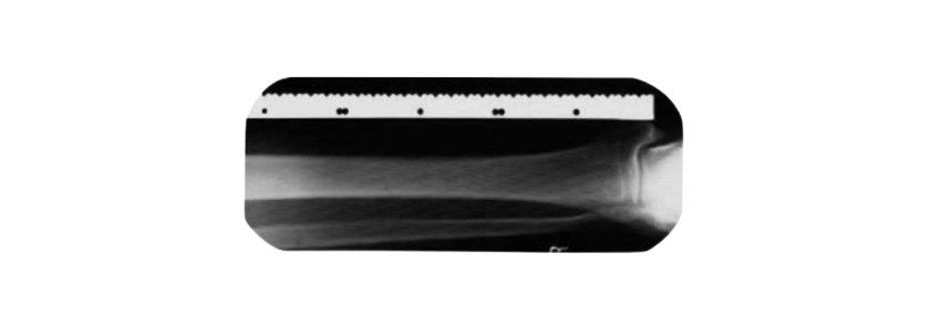 Ruler, F/ X- Ray Work | AA808R